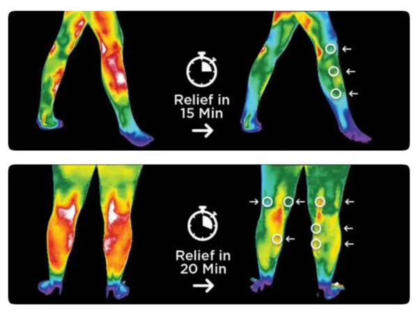 ThermaFlex Pro: 3-in-1 Smart Knee Massager